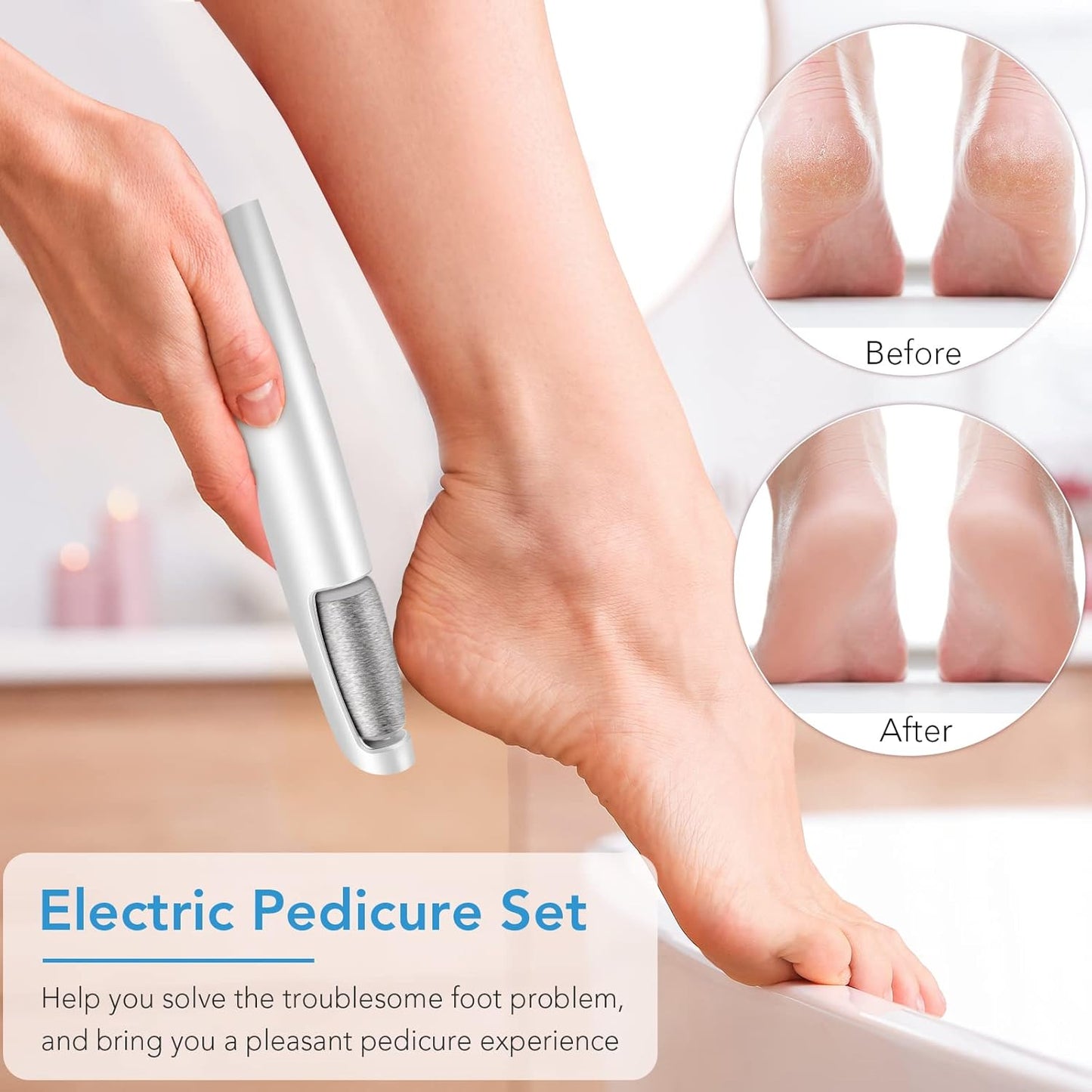 Electric Callus Remover for Feet, Professional Pedicure Kit Foot Scrubber for Dry, Dead, Cracked, Hard Skin, at Home Feet Spa Care Kit for Men & Women (Cold White)