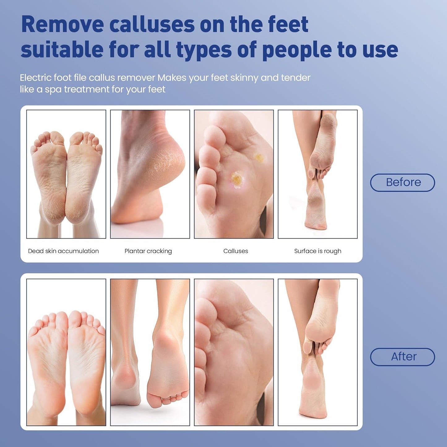 Electric Foot Callus Remover,2 in1 Rechargeable Callus Remover for Feet,9-Speed Wireless Electric Foot File Nail Grinder,Foot Scrubber Pedicure Tools for Dead Skin Dry Cracked Feet(Black MINI)