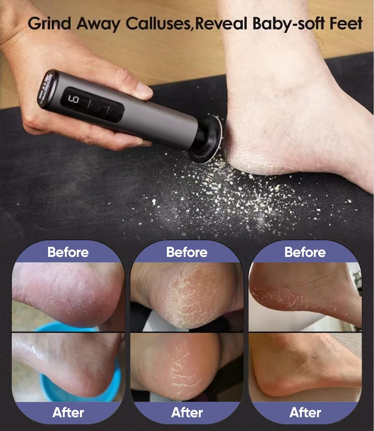 Electric Foot Callus Remover - 9 Speed Callus Remover for Feet with USB Rechargeable,Electric Foot File Pedicure Tools for Feet Dead Skin Heel Callus Hardskin Dry Cracks for Women Men (Dark Gray)